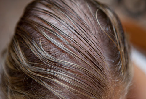 drug could regrow hair in some with hair loss